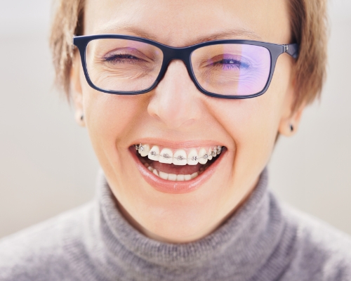 Smiling adult woman with braces