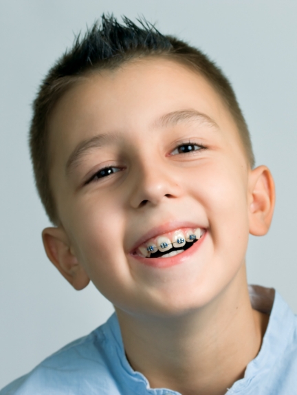 Smiling boy with braces on his upper teeth