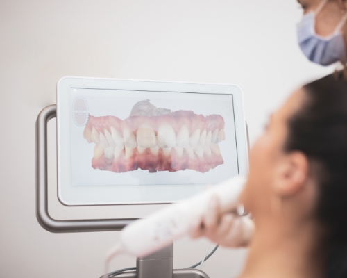 Orthodontist showing a patient a screen with digital impressions of their teeth