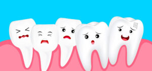 Cartoon of misaligned unhappy teeth causing dental drifting.